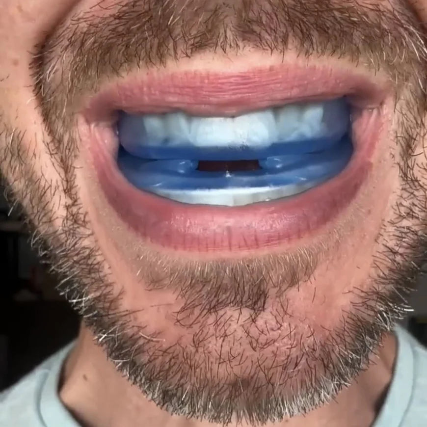 Honex® Adjustable Anti-Snoring Mouthpiece