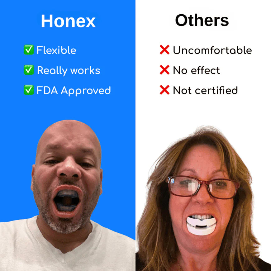 Honex® Adjustable Anti-Snoring Mouthpiece